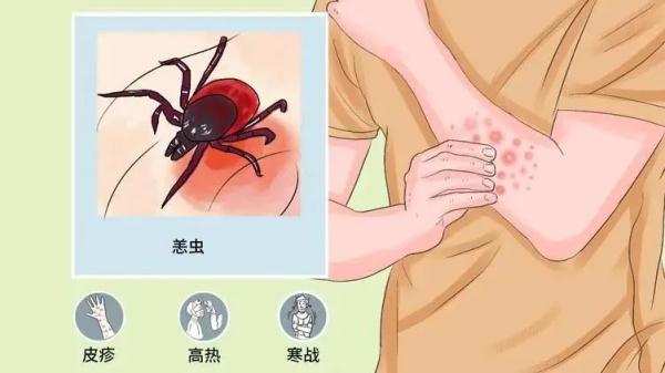 可怕!厦门:6岁男童高烧10多天!医生在他肚脐找到…… 可怕!厦门:6岁男童高烧10多天!医生在他肚脐找到……