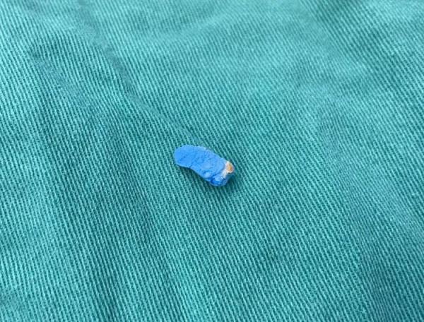 危险!4岁孩子模仿孙悟空,把“金箍棒”塞进耳朵 危险!4岁孩子模仿孙悟空,把“金箍棒”塞进耳朵