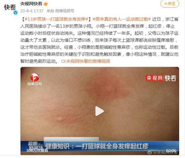 13岁男孩一打篮球就全身发痒 原来真的有运动性过敏 13岁男孩一打篮球就全身发痒 原来真的有运动性过敏
