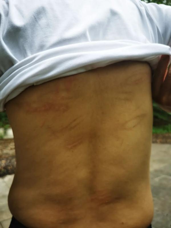 逃离缅北！拐卖、鞭打、电刑…男子亲述“噩梦三年”