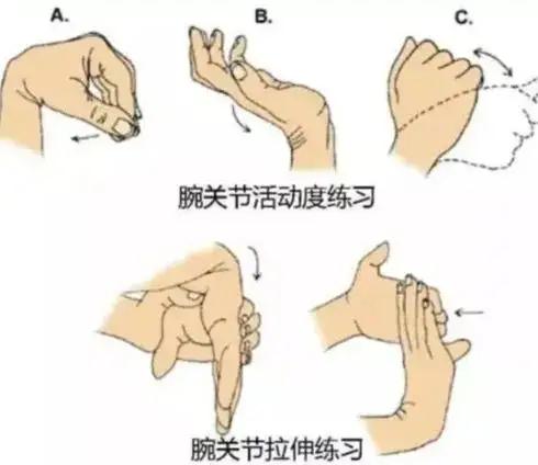 当你的手出现这些“异样”，或是腕管综合征