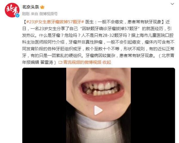 23岁女生患牙瘤拔掉57颗牙 医生：一般不会癌变