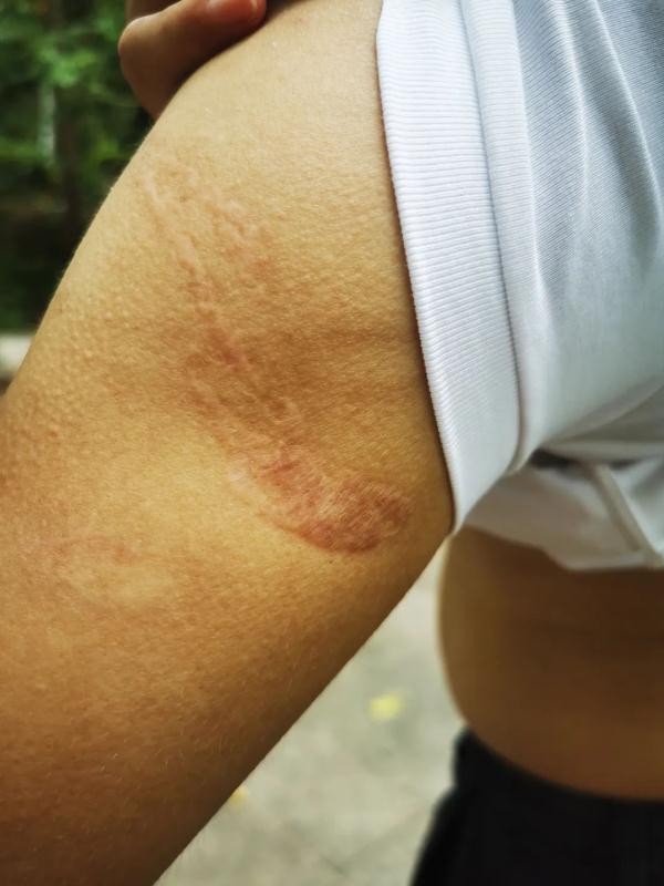 逃离缅北！拐卖、鞭打、电刑…男子亲述“噩梦三年”