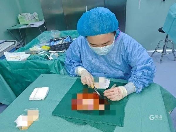 头皮瞬间被撕脱!这个游乐项目很多人爱玩… 头皮瞬间被撕脱!这个游乐项目很多人爱玩…