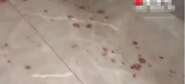 女子网购这种美味,一觉醒来炸了 女子网购这种美味,一觉醒来炸了