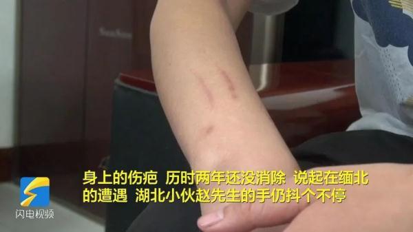 细思极恐！女孩险被诱骗至缅甸，湖北小伙被“老乡”骗至缅北遭非人折磨