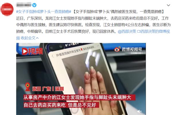 手指长这样，可能是肺癌信号？