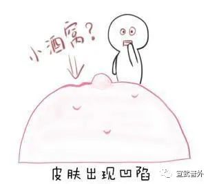 乳腺癌早期的6个危险信号