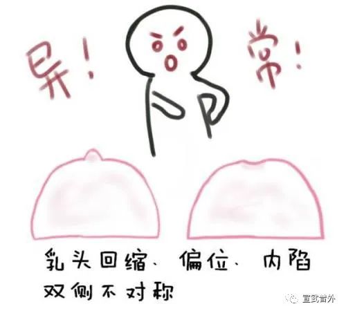 乳腺癌早期的6个危险信号
