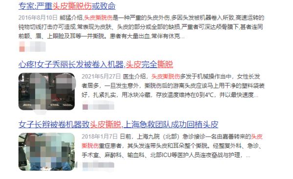 头皮瞬间被撕脱！女子在游乐场发生意外，网友：想想都痛......