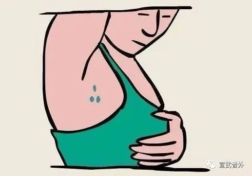 乳腺癌早期的6个危险信号