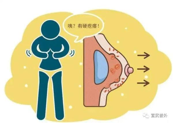 乳腺癌早期的6个危险信号