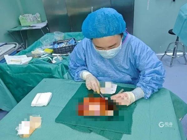 头皮瞬间被撕脱！女子在游乐场发生意外，网友：想想都痛......