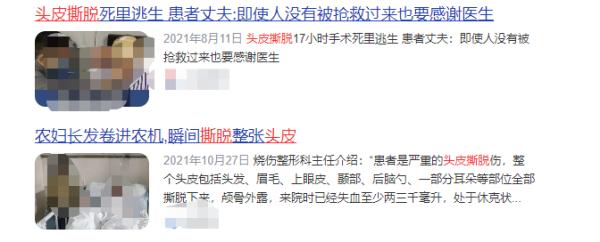 头皮瞬间被撕脱！女子在游乐场发生意外，网友：想想都痛......