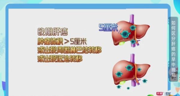 肿瘤之王?发现等于生命倒计时?专家:1/3有望治愈! 肿瘤之王?发现等于生命倒计时?专家:1/3有望治愈!