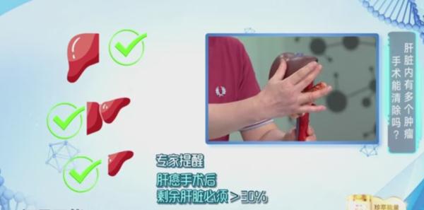 肿瘤之王?发现等于生命倒计时?专家:1/3有望治愈! 肿瘤之王?发现等于生命倒计时?专家:1/3有望治愈!