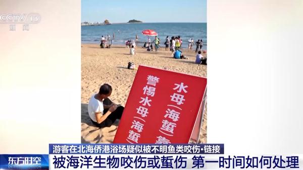 广西北海，咬伤游客的不明生物到底是什么？