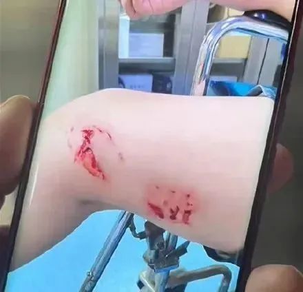 专家推测：北海咬伤游客的可能是这种鱼类