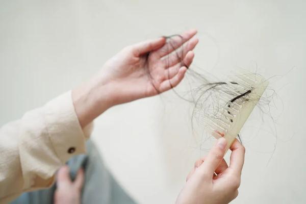 大把掉头发、发际线越来越高……别慌!看这里→ 大把掉头发、发际线越来越高……别慌!看这里→