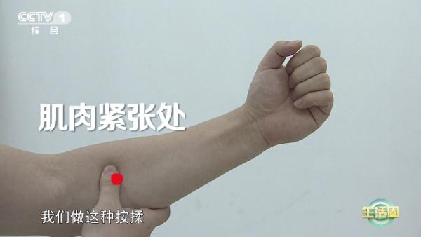 【养生】经常做这5个动作的你,小心腱鞘炎找上门!快试试这2个方法 【养生】经常做这5个动作的你,小心腱鞘炎找上门!快试试这2个方法