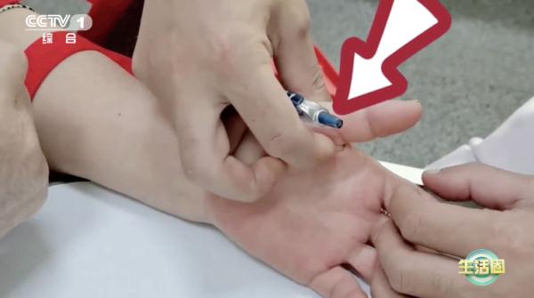 【养生】经常做这5个动作的你,小心腱鞘炎找上门!快试试这2个方法 【养生】经常做这5个动作的你,小心腱鞘炎找上门!快试试这2个方法