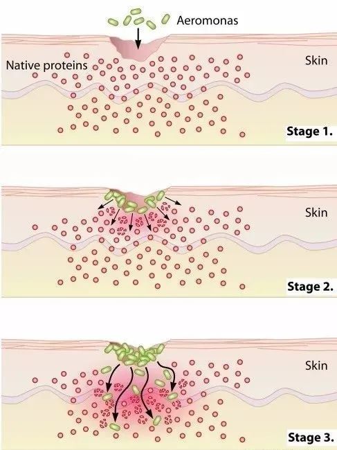 太可怕!这个夏日美食竟然让一男子骤然去世,家人百思不解 太可怕!这个夏日美食竟然让一男子骤然去世,家人百思不解