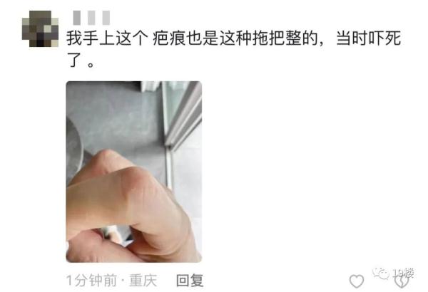 万万没想到的"伤人狂魔"！有人差点被割断血管！这种拖把很多人家里有