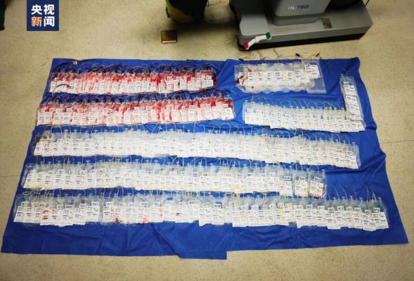 救回来了！产妇羊水栓塞，医生讲述生死救援