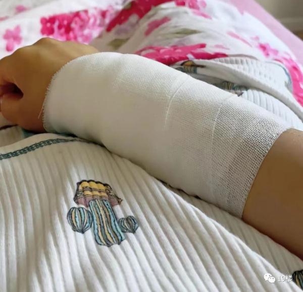 万万没想到的"伤人狂魔"！有人差点被割断血管！这种拖把很多人家里有