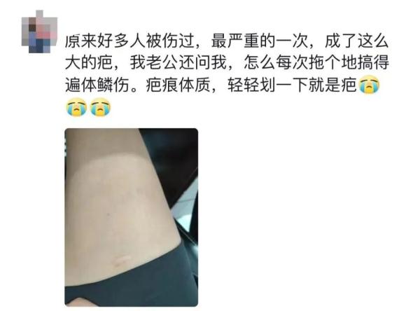 警惕！已有多人因拖把、扫帚受伤！