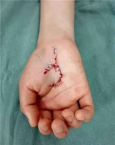 警惕！已有多人因拖把、扫帚受伤！