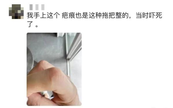 警惕！已有多人因拖把、扫帚受伤！