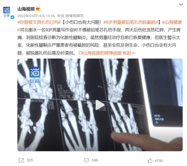 孩子被铅笔扎伤,会有毒吗?要不要打破伤风? 孩子被铅笔扎伤,会有毒吗?要不要打破伤风?