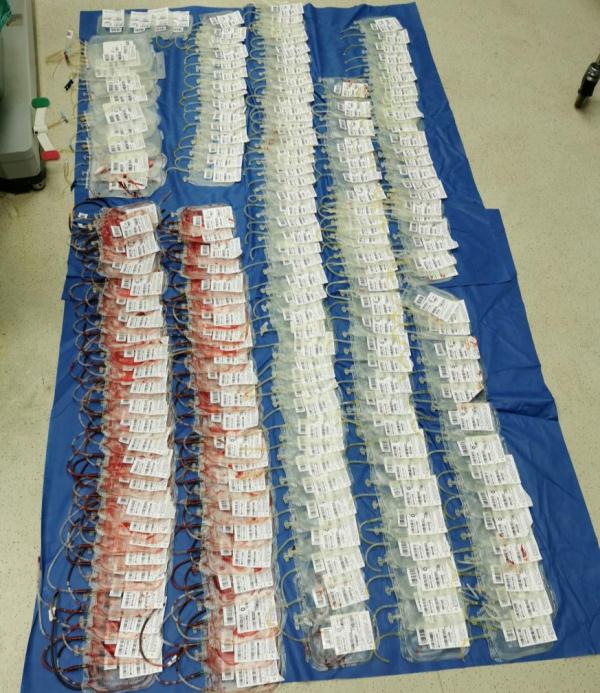 输血超6万毫升，她被救过来了！医生讲述生死救援……