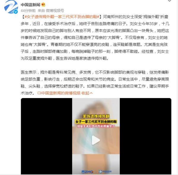 女子遗传“拇指外翻” 一家三代买不到合脚的鞋