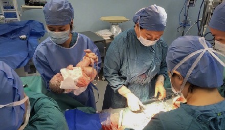 深圳首例！肝移植术后孕妇成功产子