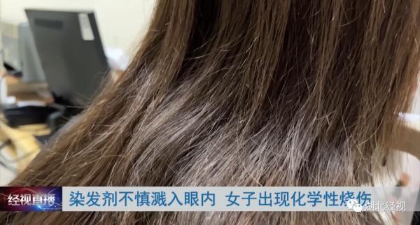 可怕！女子在家染头发，染发剂不小心溅入眼睛，下一秒……
