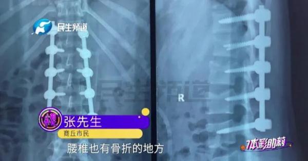 心疼！女孩刚收到大学录取通知书，意外坠入4层楼高电梯井……