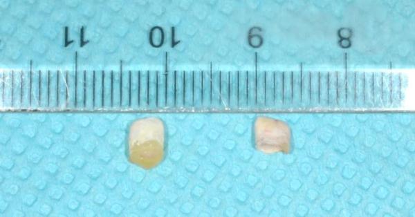出生15天,就长了2颗牙? 出生15天,就长了2颗牙?