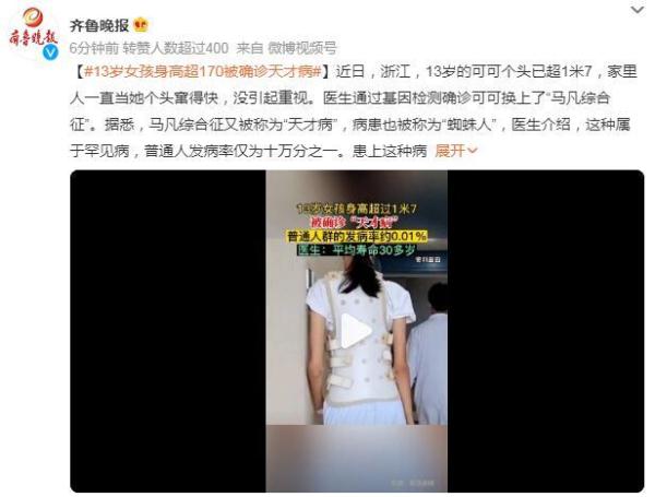 13岁女孩身高超170被确诊“天才病”