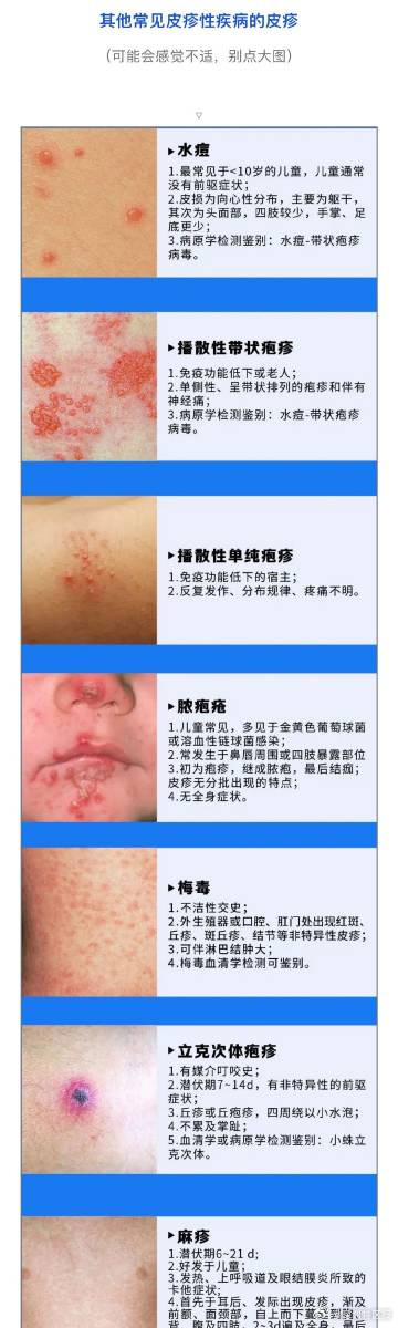 深圳8月新增62例猴痘确诊病例