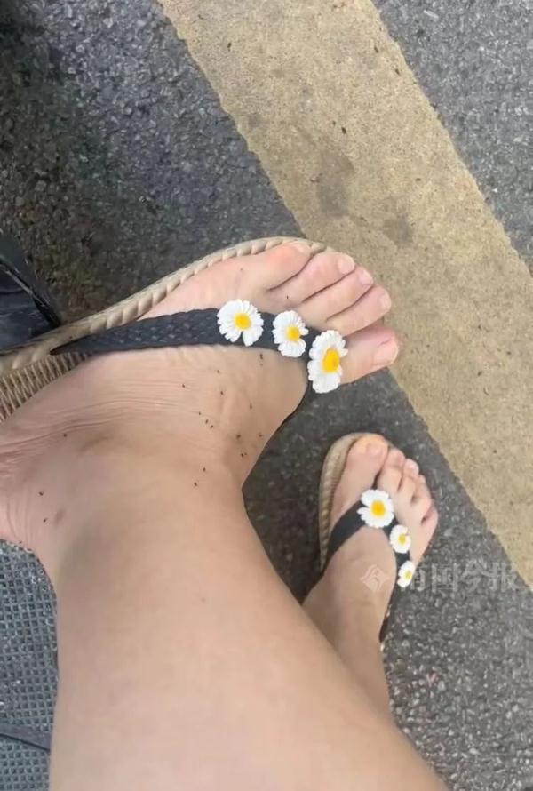 小区车库跳蚤出没，业主晒图满腿是包！解决方案来了