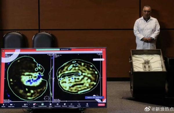 热搜爆了!“外星人尸体”被展出→ 热搜爆了!“外星人尸体”被展出→