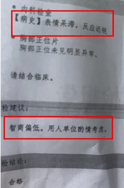 表情呆滞、反应迟钝…医院体检报告上写"智商偏低"？