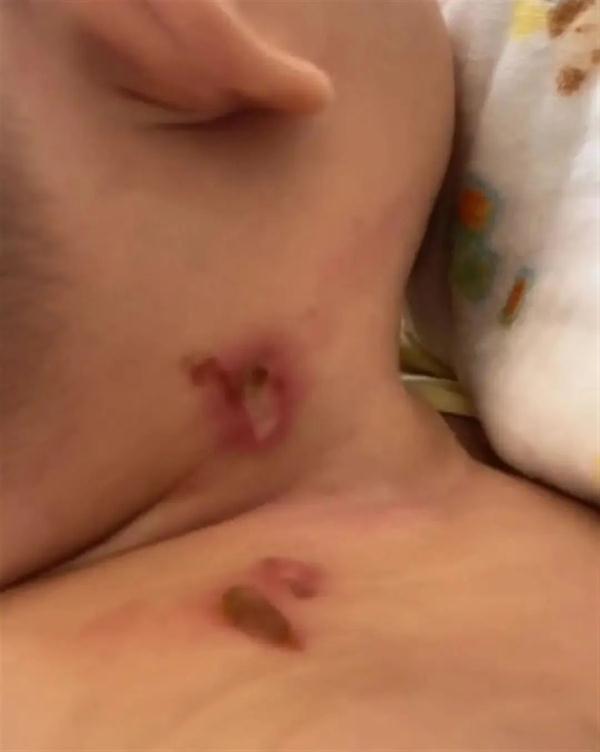 高空掉烟头烫伤婴儿！全楼验DNA，锁定嫌疑人