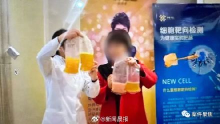 净化血液有什么仪器上海一女子花84万净化血液差点丧命：做了一年多人却半死不活-上海聚慕医疗器械有限公司