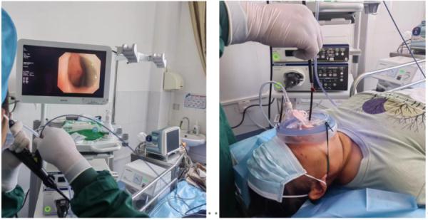 女子气管内藏着8厘米蚂蟥！取出时还在蠕动