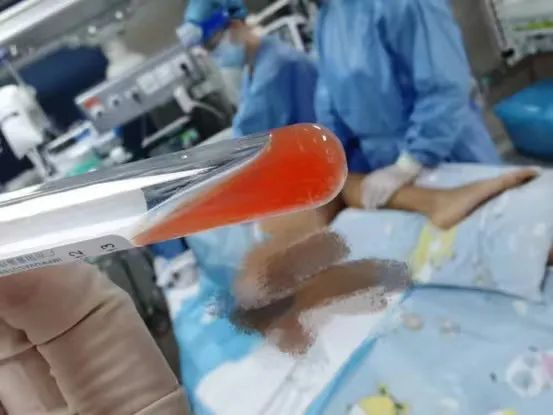 致死率超95%!14岁少年野泳后感染“食脑虫”,医生提醒 致死率超95%!14岁少年野泳后感染“食脑虫”,医生提醒