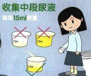 尿检时为什么要留晨起“第一泡尿”？