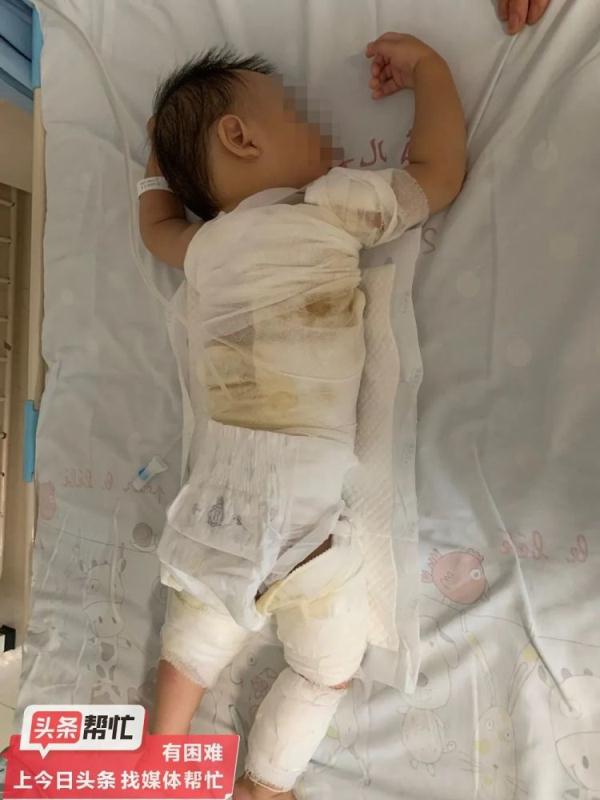 保姆疏忽致婴儿被开水烫伤!家政公司:不能责任全归我们 保姆疏忽致婴儿被开水烫伤!家政公司:不能责任全归我们